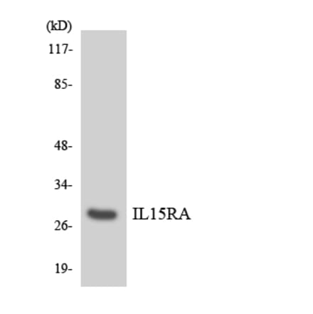 Western Blot - Anti-IL15RA Antibody (R12-2918) - Antibodies.com
