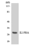 Western Blot - Anti-IL15RA Antibody (R12-2918) - Antibodies.com