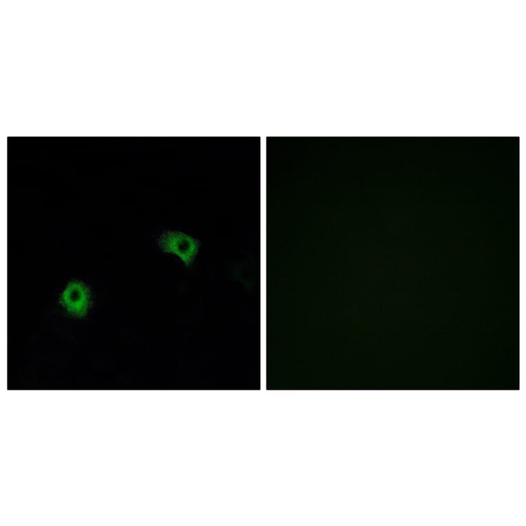 Immunofluorescence - Anti-GPR116 Antibody (G124) - Antibodies.com