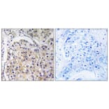 Immunohistochemistry - Anti-GPR116 Antibody (G124) - Antibodies.com