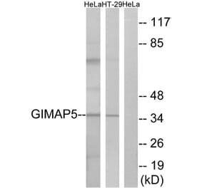 Western Blot - Anti-GIMAP5 Antibody (C16005) - Antibodies.com