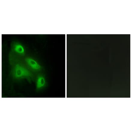 Immunofluorescence - Anti-EPS8L3 Antibody (C11394) - Antibodies.com