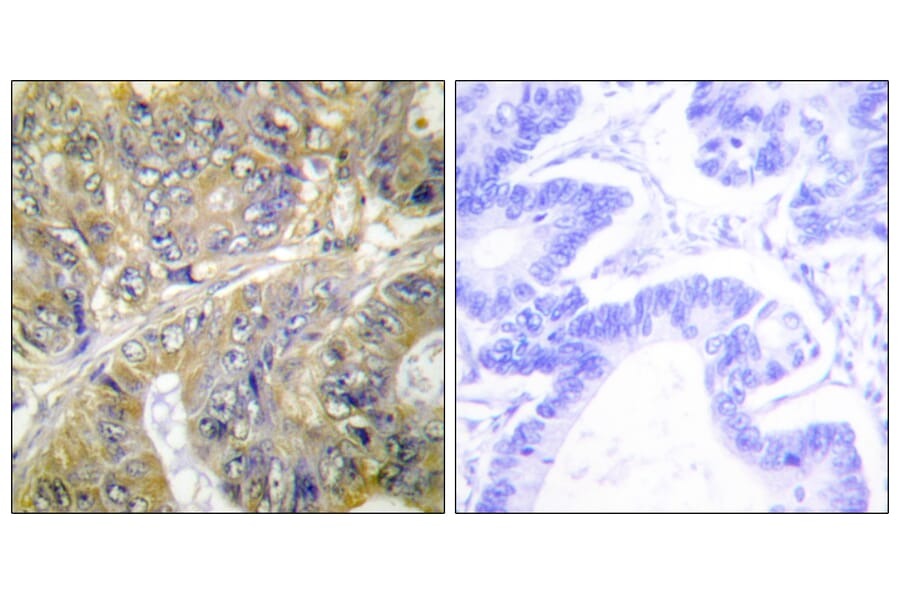 Immunohistochemistry - Anti-EPS8L3 Antibody (C11394) - Antibodies.com