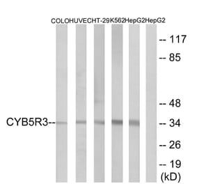 Western Blot - Anti-CYB5R3 Antibody (C16853) - Antibodies.com