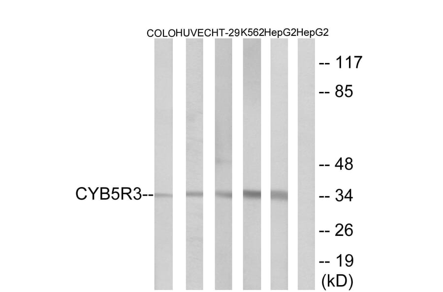 Western Blot - Anti-CYB5R3 Antibody (C16853) - Antibodies.com
