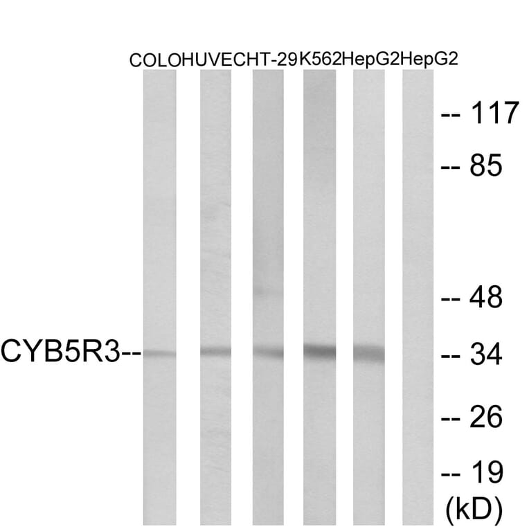 Western Blot - Anti-CYB5R3 Antibody (C16853) - Antibodies.com