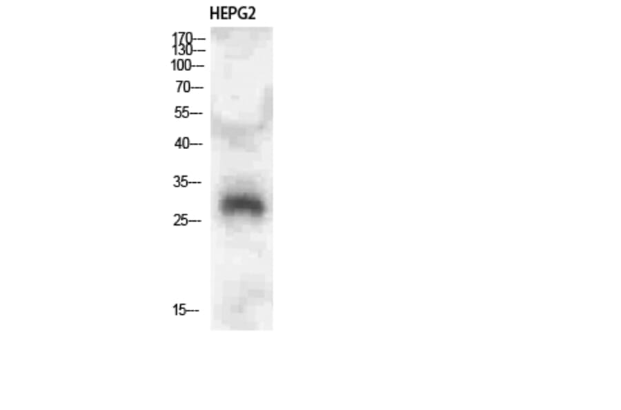 Western Blot - Anti-CLEC4A Antibody (C31042) - Antibodies.com