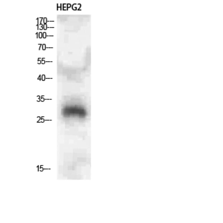 Western Blot - Anti-CLEC4A Antibody (C31042) - Antibodies.com