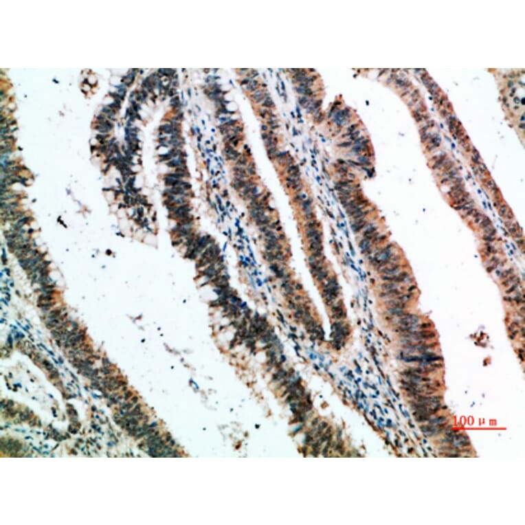 Immunohistochemistry - Anti-CLEC4A Antibody (C31042) - Antibodies.com