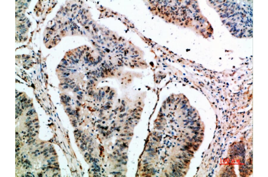 Immunohistochemistry - Anti-CLEC4A Antibody (C31042) - Antibodies.com