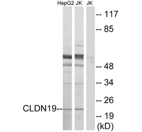 Western Blot - Anti-CLDN19 Antibody (C15153) - Antibodies.com