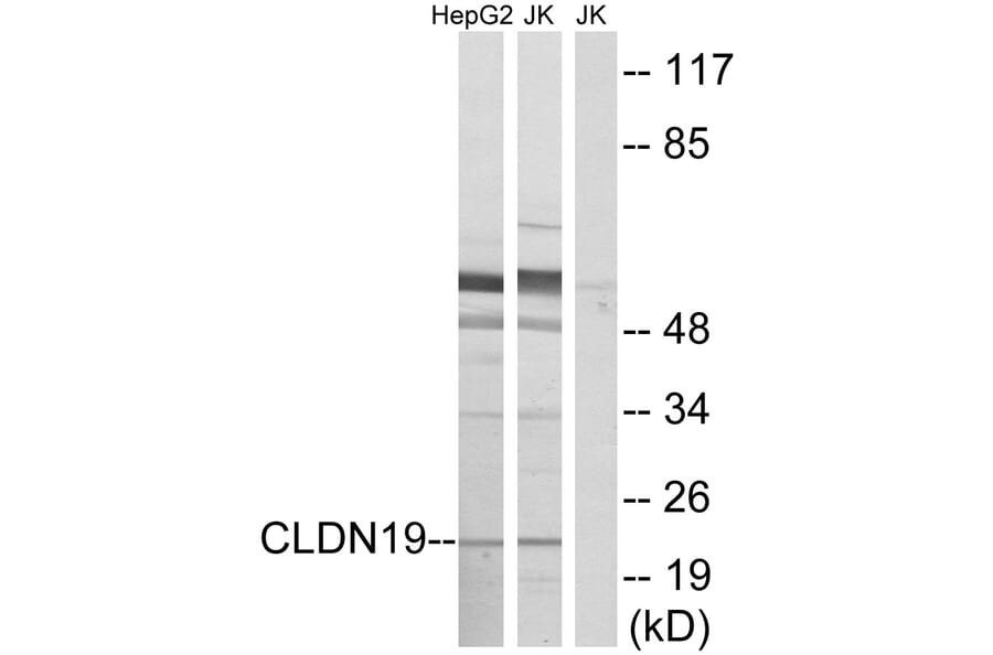 Western Blot - Anti-CLDN19 Antibody (C15153) - Antibodies.com