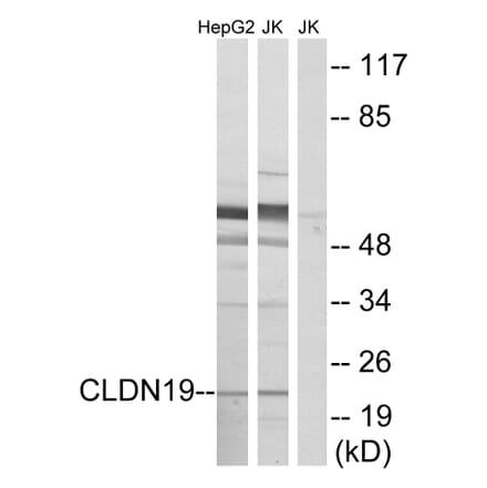 Western Blot - Anti-CLDN19 Antibody (C15153) - Antibodies.com