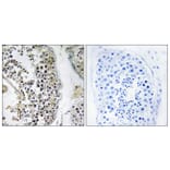 Immunohistochemistry - Anti-CEP170 Antibody (C15040) - Antibodies.com