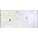 Immunohistochemistry - Anti-CELSR3 Antibody (C12184) - Antibodies.com