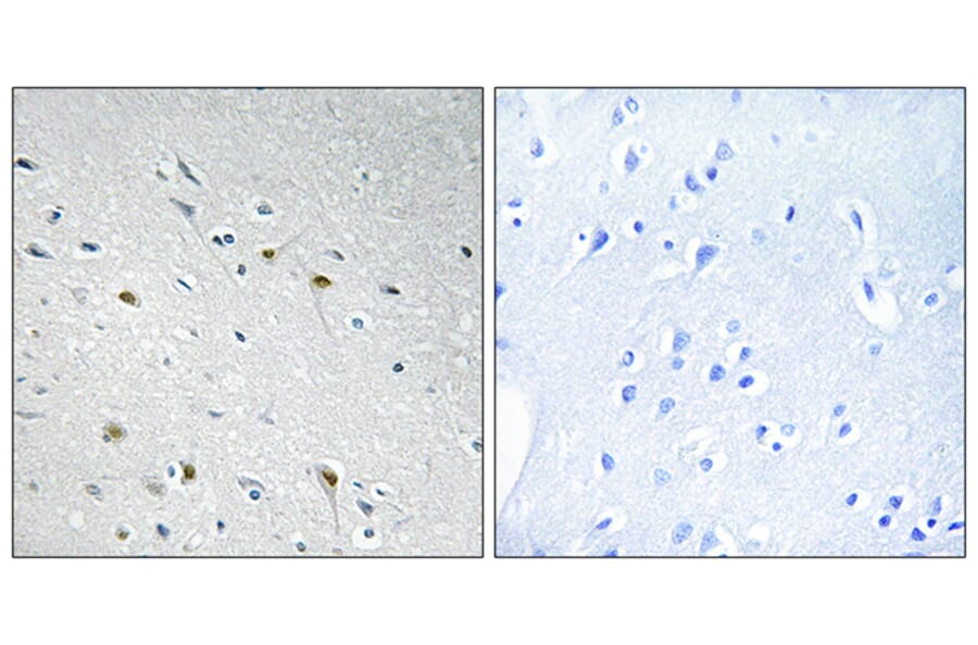 Immunohistochemistry - Anti-CDC25C Antibody (B0628) - Antibodies.com