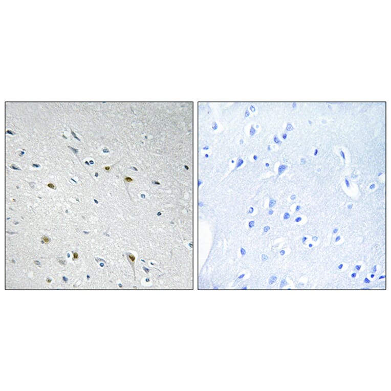 Immunohistochemistry - Anti-CDC25C Antibody (B0628) - Antibodies.com