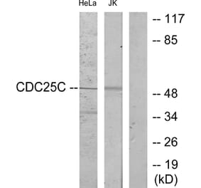 Western Blot - Anti-CDC25C Antibody (B7038) - Antibodies.com
