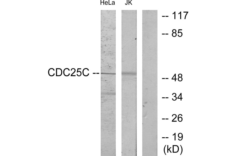 Western Blot - Anti-CDC25C Antibody (B7038) - Antibodies.com