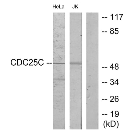 Western Blot - Anti-CDC25C Antibody (B7038) - Antibodies.com