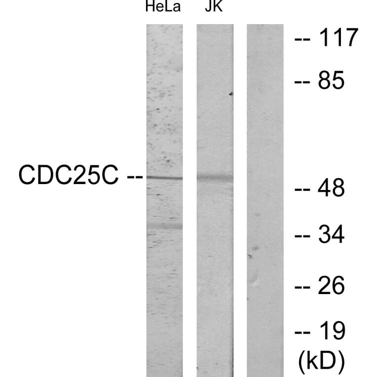 Western Blot - Anti-CDC25C Antibody (B7038) - Antibodies.com