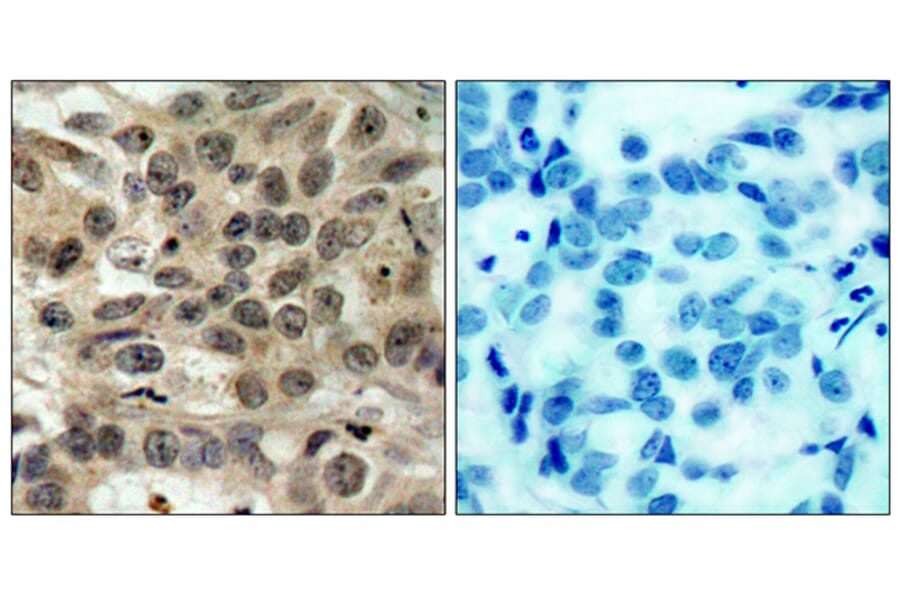 Immunohistochemistry - Anti-CDC25C Antibody (B7038) - Antibodies.com