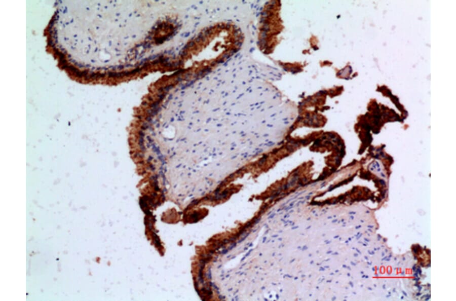 Immunohistochemistry - Anti-ANGPT1 Antibody (C30080) - Antibodies.com
