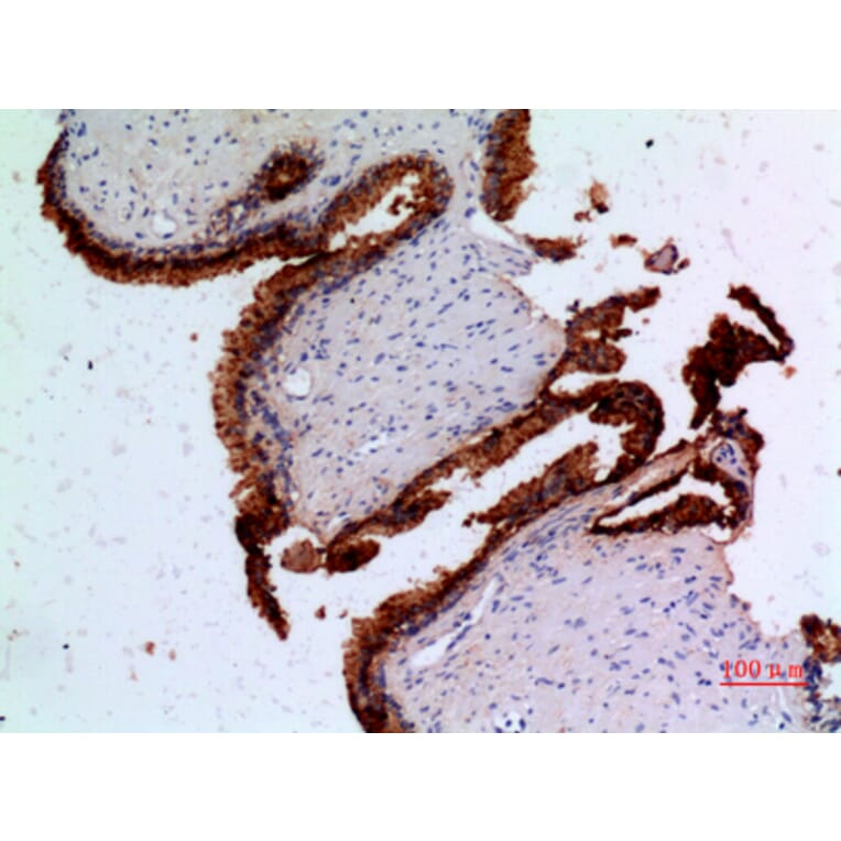 Immunohistochemistry - Anti-ANGPT1 Antibody (C30080) - Antibodies.com