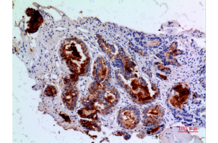Immunohistochemistry - Anti-ANGPT1 Antibody (C30080) - Antibodies.com