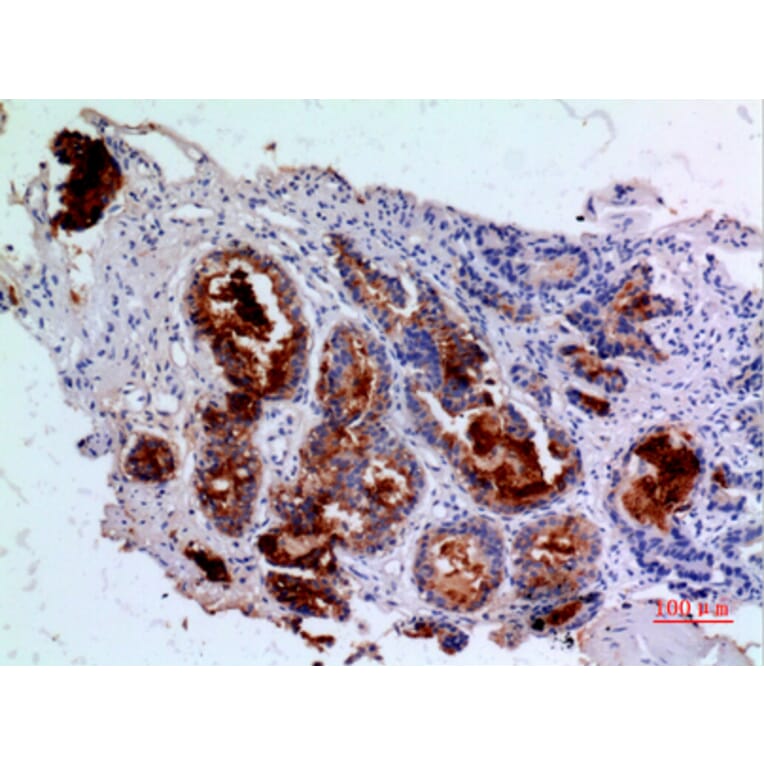 Immunohistochemistry - Anti-ANGPT1 Antibody (C30080) - Antibodies.com