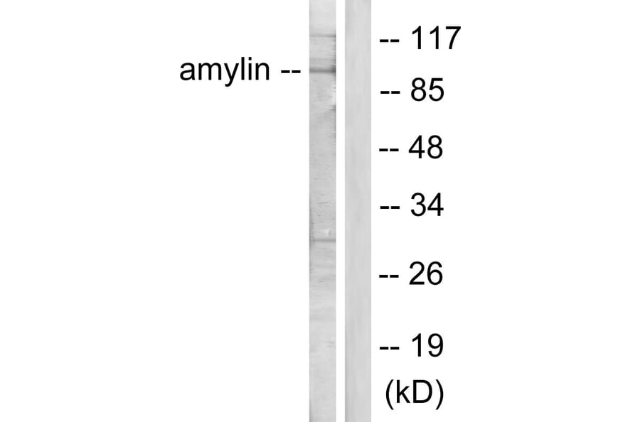 Western Blot - Anti-Amylin Antibody (C0125) - Antibodies.com