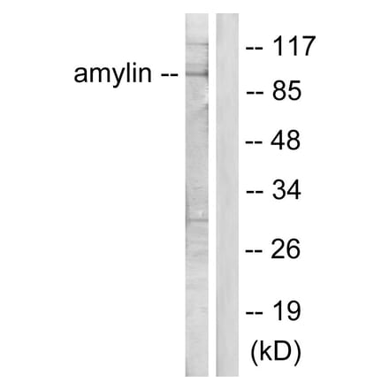 Western Blot - Anti-Amylin Antibody (C0125) - Antibodies.com