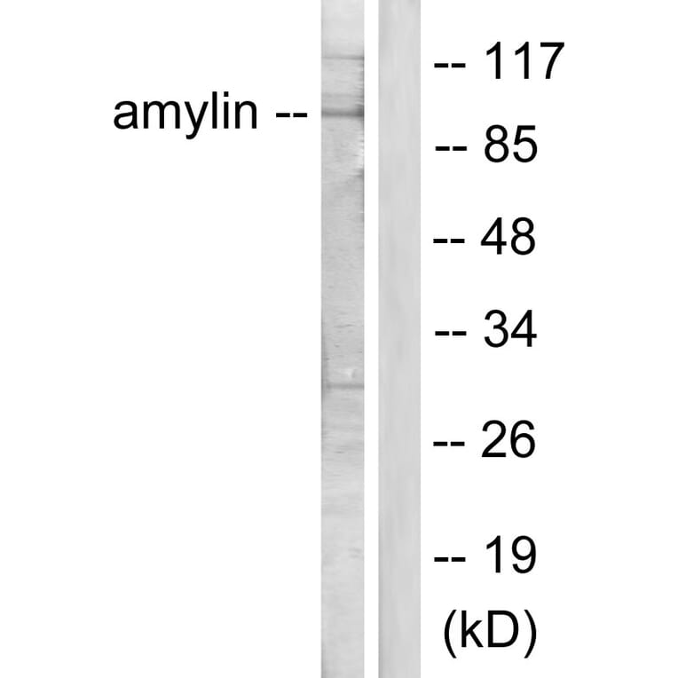 Western Blot - Anti-Amylin Antibody (C0125) - Antibodies.com