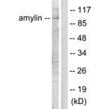 Western Blot - Anti-Amylin Antibody (C0125) - Antibodies.com