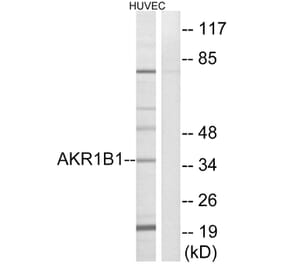 Western Blot - Anti-AKR1B1 Antibody (C14400) - Antibodies.com