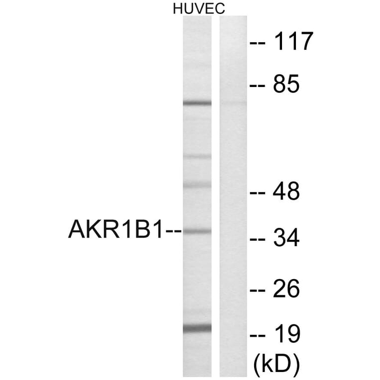 Western Blot - Anti-AKR1B1 Antibody (C14400) - Antibodies.com