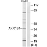 Western Blot - Anti-AKR1B1 Antibody (C14400) - Antibodies.com