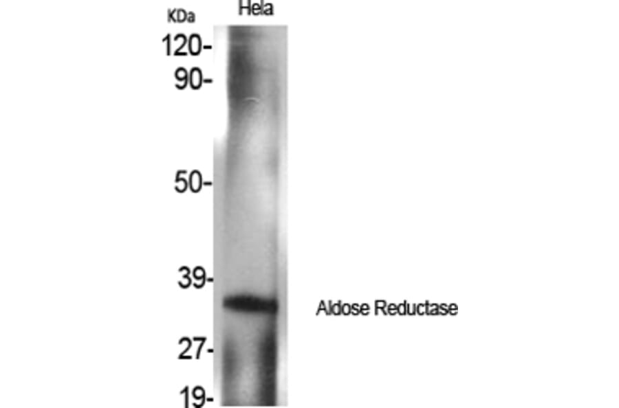 Western Blot - Anti-AKR1B1 Antibody (C14400) - Antibodies.com