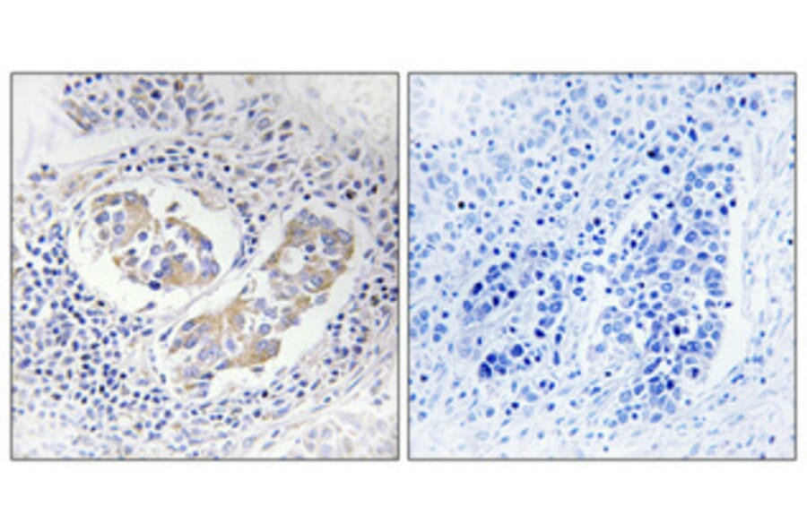 Immunohistochemistry - Anti-AKR1B1 Antibody (C14400) - Antibodies.com