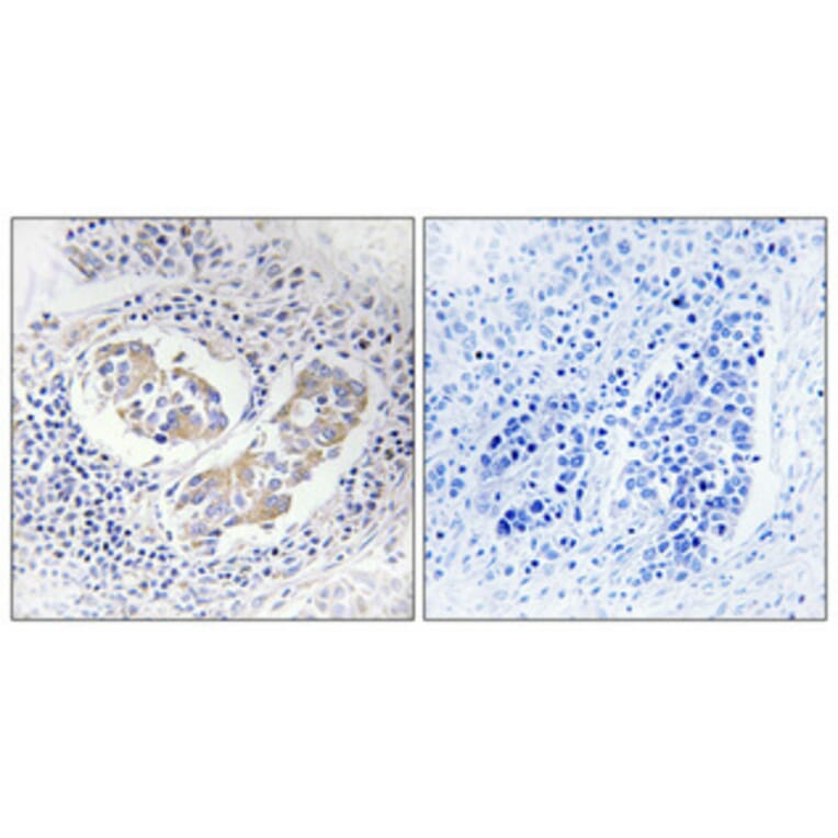 Immunohistochemistry - Anti-AKR1B1 Antibody (C14400) - Antibodies.com