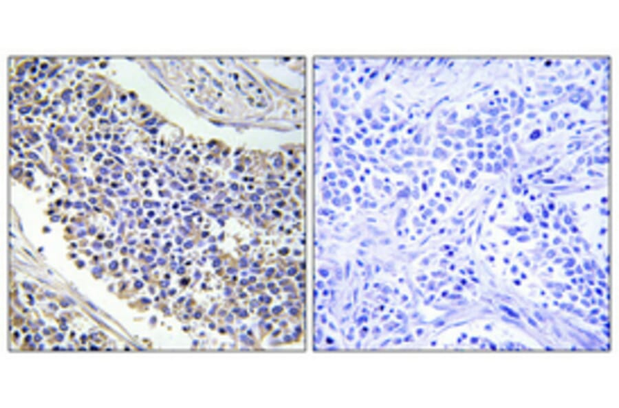 Immunohistochemistry - Anti-AKR1B1 Antibody (C14400) - Antibodies.com