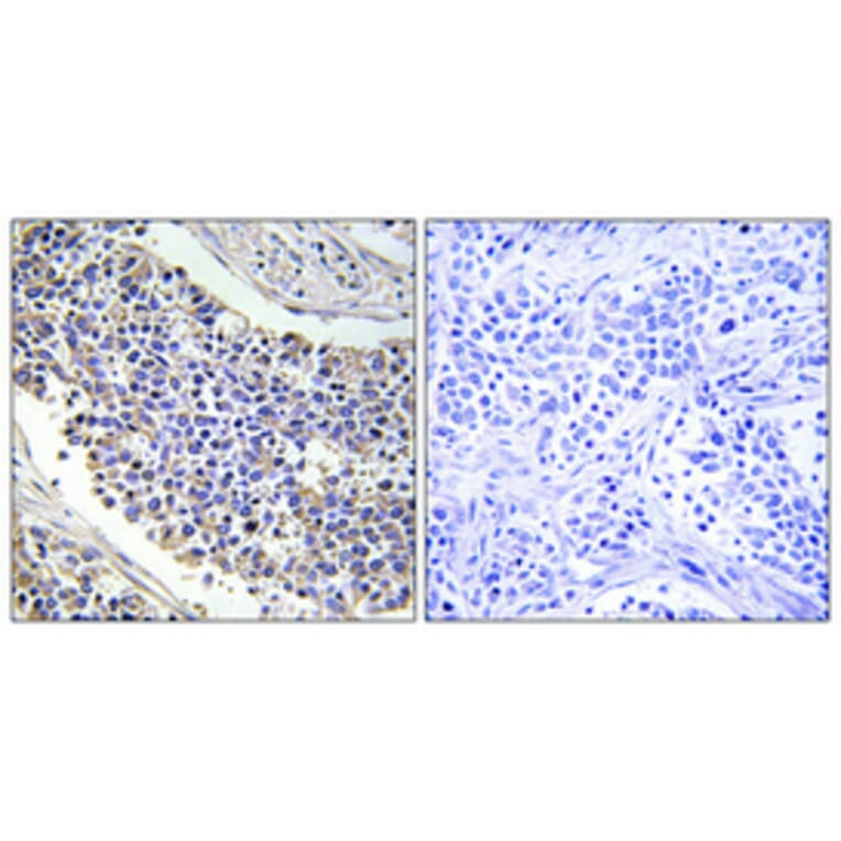 Immunohistochemistry - Anti-AKR1B1 Antibody (C14400) - Antibodies.com