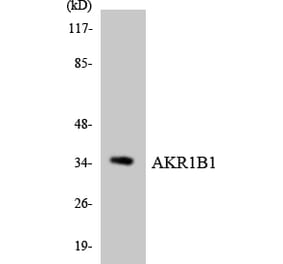 Western Blot - Anti-AKR1B1 Antibody (R12-2471) - Antibodies.com