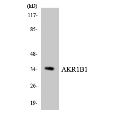 Western Blot - Anti-AKR1B1 Antibody (R12-2471) - Antibodies.com