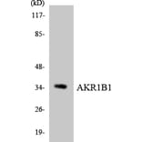 Western Blot - Anti-AKR1B1 Antibody (R12-2471) - Antibodies.com