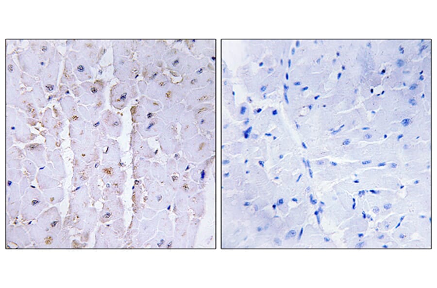 Immunohistochemistry - Anti-AKAP13 Antibody (C10921) - Antibodies.com