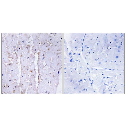 Immunohistochemistry - Anti-AKAP13 Antibody (C10921) - Antibodies.com