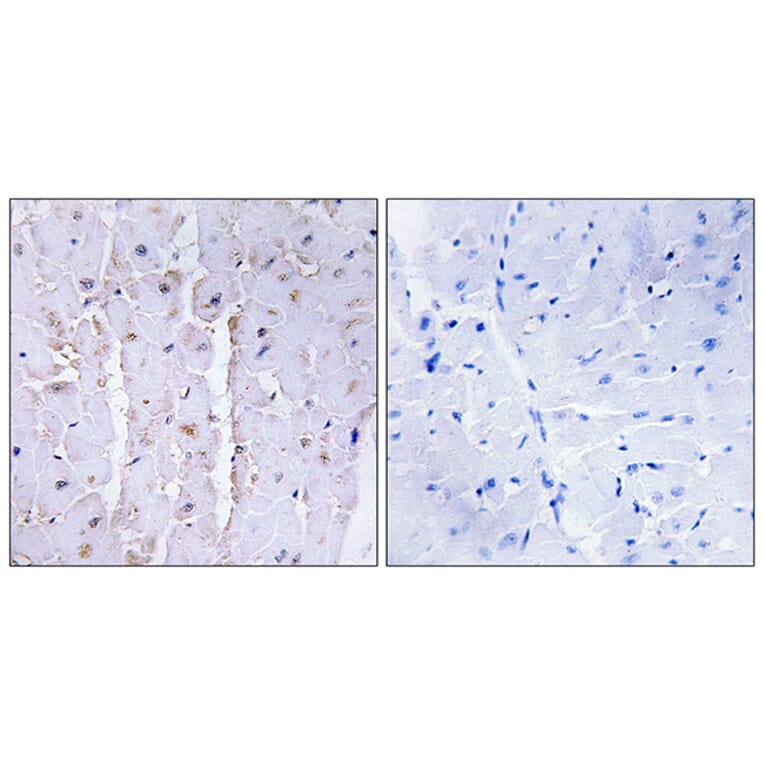 Immunohistochemistry - Anti-AKAP13 Antibody (C10921) - Antibodies.com