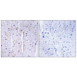 Immunohistochemistry - Anti-AKAP13 Antibody (C10921) - Antibodies.com