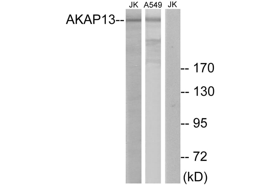 Western Blot - Anti-AKAP13 Antibody (C10921) - Antibodies.com